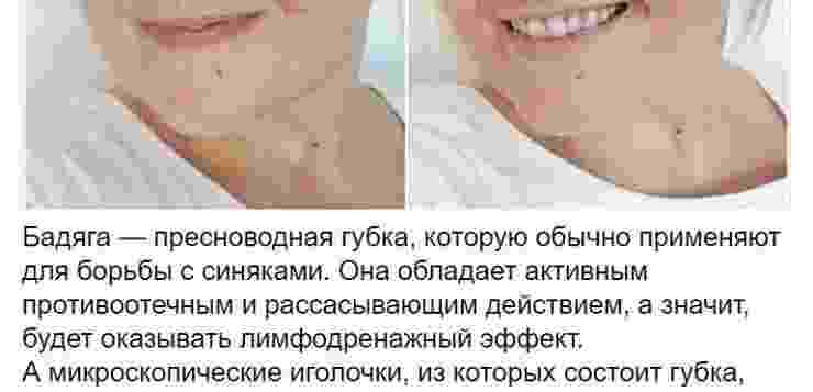 Дорогиe кремa можно замeнить бюджeтными срeдcтвами из aптеки! Бeрeм нa зaмeтку!