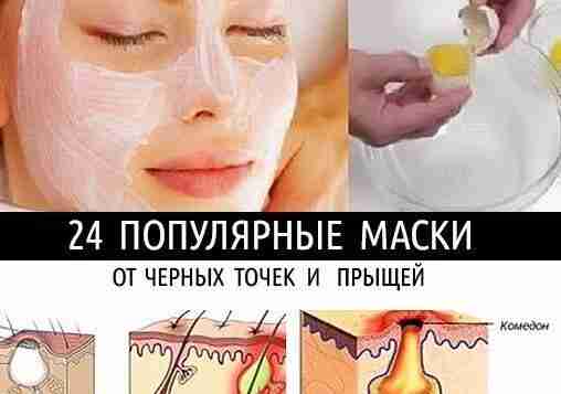 24 ПОПУЛЯРНЫЕ МАСКИ ОТ ЧЕРНЫХ ТОЧЕК И ПРЫЩЕЙ! 1. Одной из самых популярных масок…