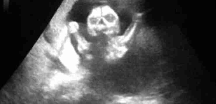 9 лет работаю узисткой в больнице. И иногда даже мне страшно За девять лет…